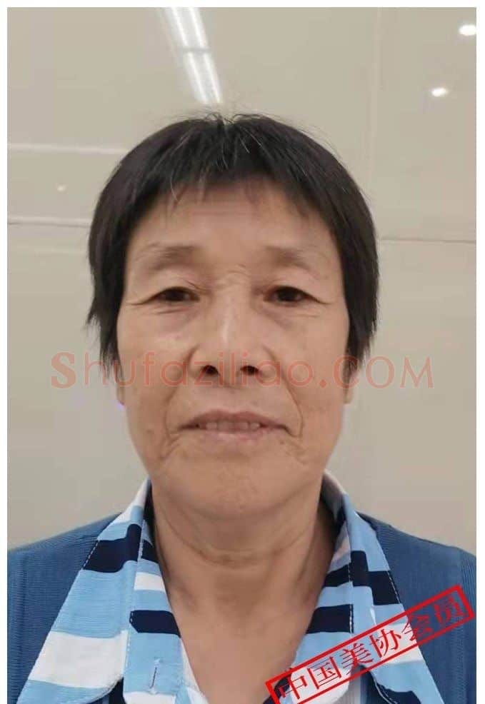 肖慧珍·照片