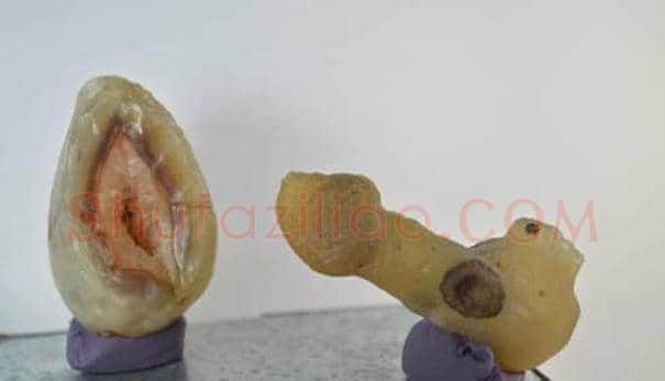 ​天然绝配的玛瑙阴阳奇石生命起源